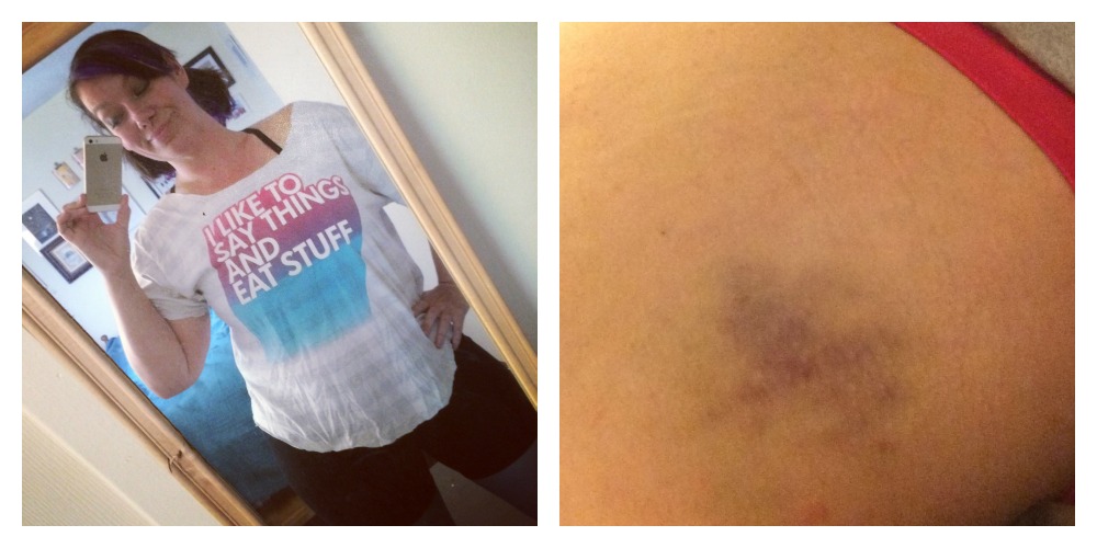 derby outfit bruise